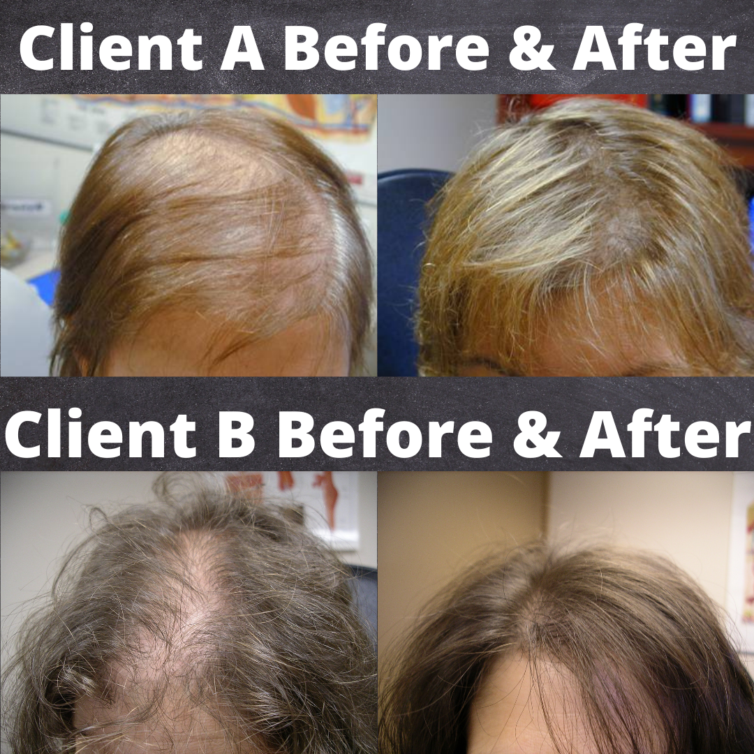 Trichology & Hair Loss Services | Carolyn Anderson Beautiful, LLC